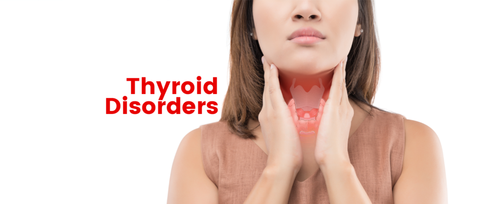 Thyroid Disease Serumlabs