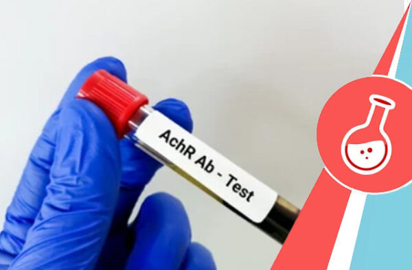 achr antibody test Serum Labs